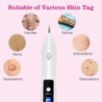 Portable Skin Tag Repair Kit with 6 Replaceable Needles - Image 11